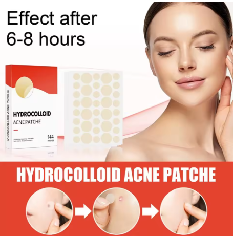 144 Pcs Acne Pimple Patches – Invisible Healing Spot Stickers