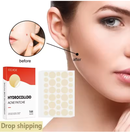 144 Pcs Acne Pimple Patches – Invisible Healing Spot Stickers