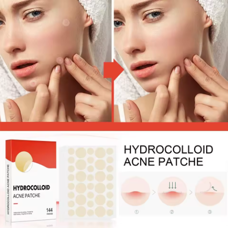 144 Pcs Acne Pimple Patches – Invisible Healing Spot Stickers